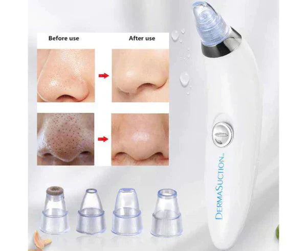 Blackhead Removal Machine