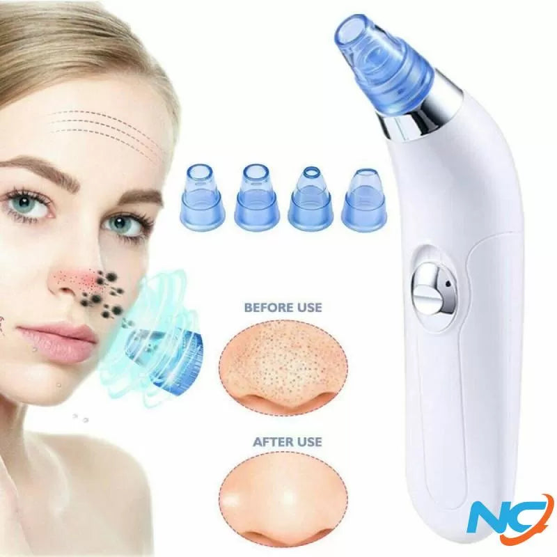 Blackhead Removal Machine